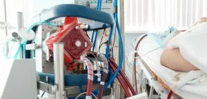 ECMO First Aid Equipment