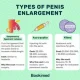 Penile Enlargement