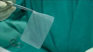 Surgical Mesh Market