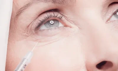 Belotero Filler