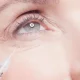 Belotero Filler