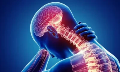 Neuralgia Treatment