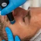 HydraFacial Treatment