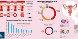 Cervical Cancer Treatment