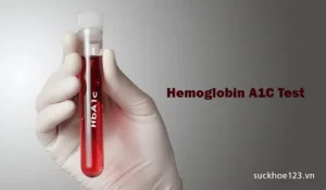 Hemoglobin A1c Testing Devices