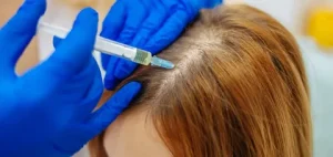 Exosome Hair