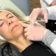 PRP injections