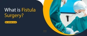 Fistula Treatment