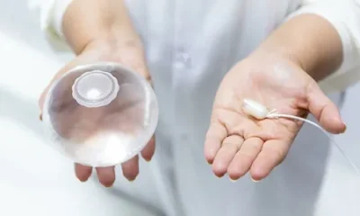 Gastric Balloon