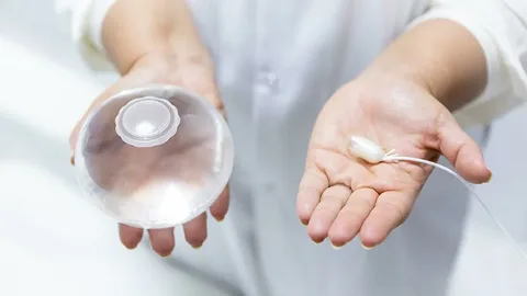 Gastric Balloon