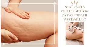 Cellulite Treatment