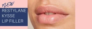 Restylane Kysse