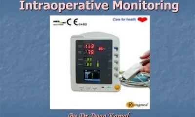 Intraoperative Monitoring Solutions