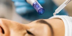 Micro needling