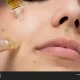 Micro needling