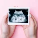 4D Ultrasound