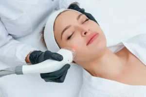 Laser Scar Removal