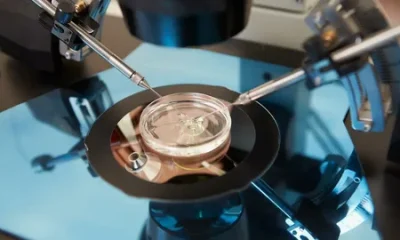 ICSI Treatment