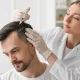 Hair Fillers treatment