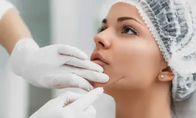 Facelift with Silhouette Threads
