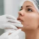 Facelift with Silhouette Threads