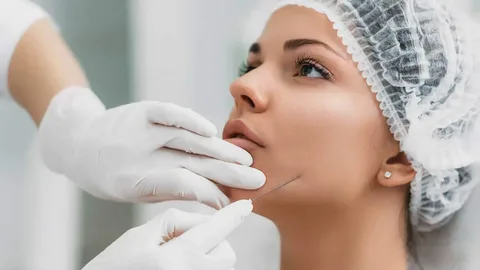 Facelift with Silhouette Threads