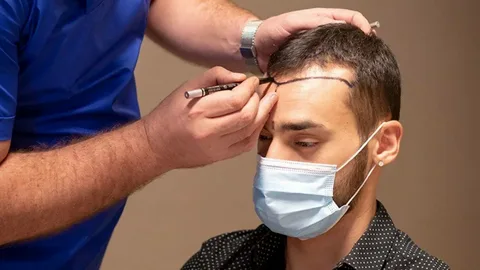 1 Dirham Hair Transplant