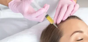 PRP Hair Treatment