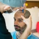 Hair Transplant