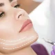 facelift